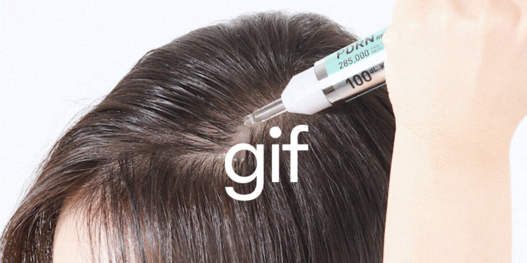 バズっている韓国コスメ：VTコスメティックス PDRN リードルショット ヘア アンプル [100dL]を頭皮に直接塗布しているシーンで、髪を分けた頭皮にアンプルの先端が当たり、中身が垂れている様子が写っている。頭皮への集中ケアを強調した使用イメージ。