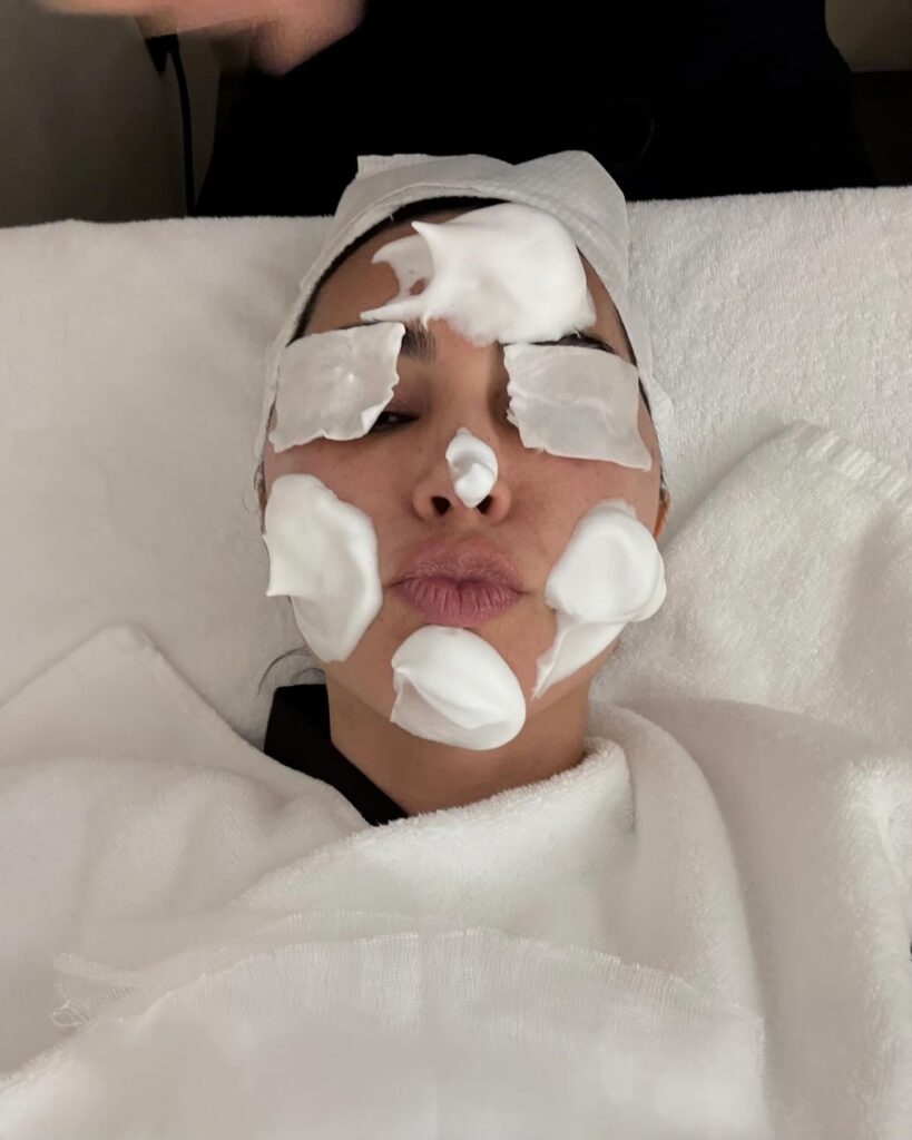 kim kardashian skin photographed during a Korean dermatology treatment, with soothing pads and recovery-focused skincare applied to the face