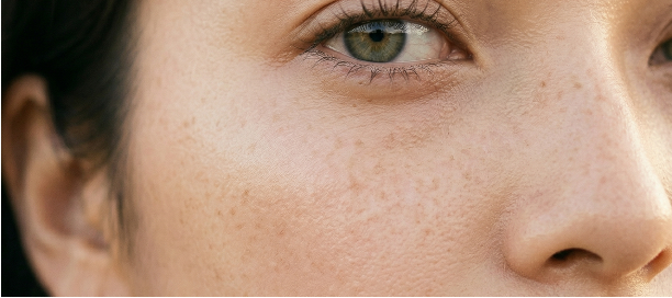 Close-up of the area around a woman's eye showing light freckles and subtle pigmentation on the cheek